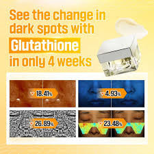 Numbuzin No.5 Vitamin Glutathione Dark Spot Laser Cream 50ml / 1.69 fl