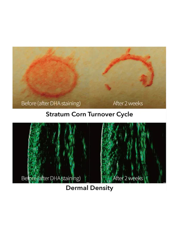 Turnover Ampoule 30ml