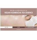 Vegan Kombucha Tea Essence 5.07 fl.oz. / 150ml