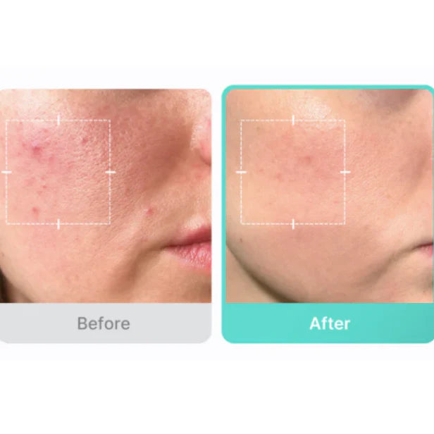 Medicube Azelaic Acid 16 BB Calming Serum