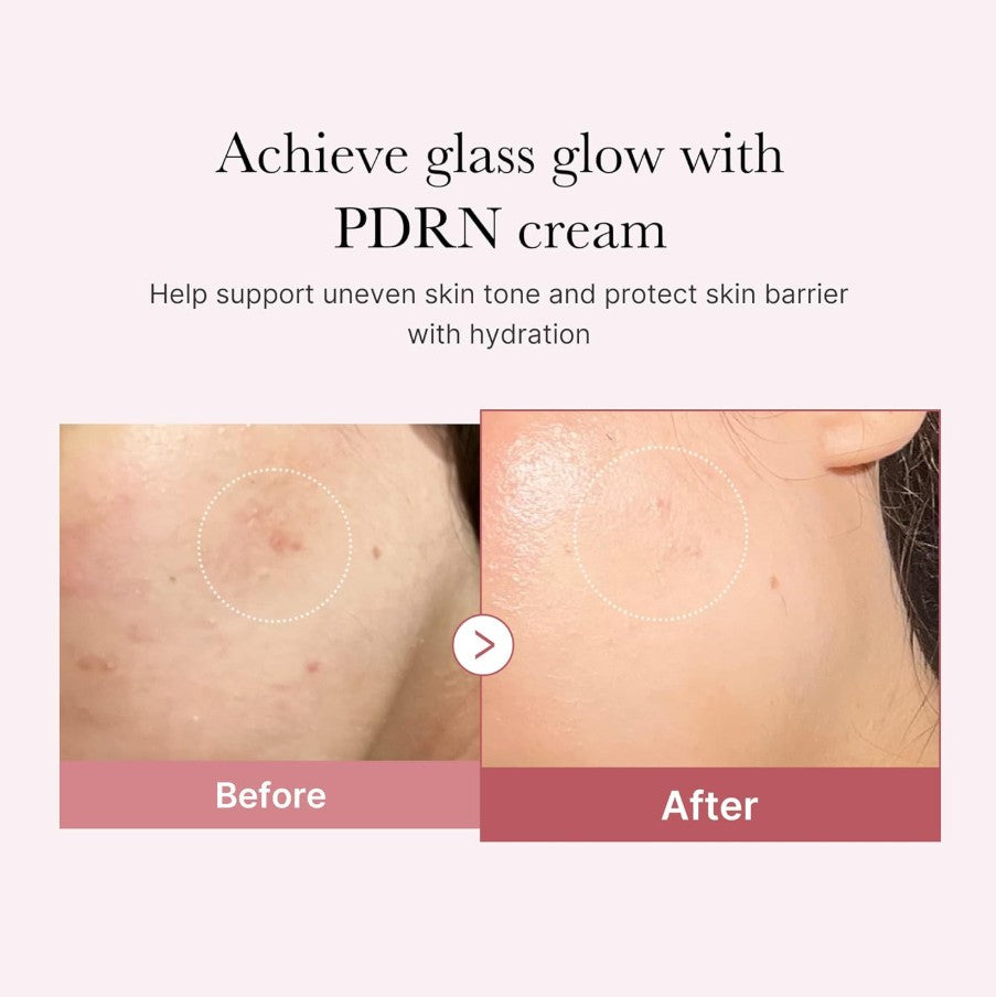 Salmon DNA PDRN Pink Hyaluronic Moisturizing Cream 50ml / 1.69 fl. oz.