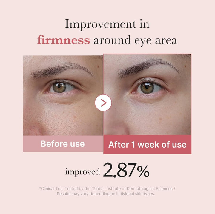 PDRN Pink Peptide Eye Cream 30ml / 1.01 fl. oz.
