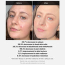 Medicube Red Acne Succinic Acid Peel Serum 40ml / 1.41 fl. oz.