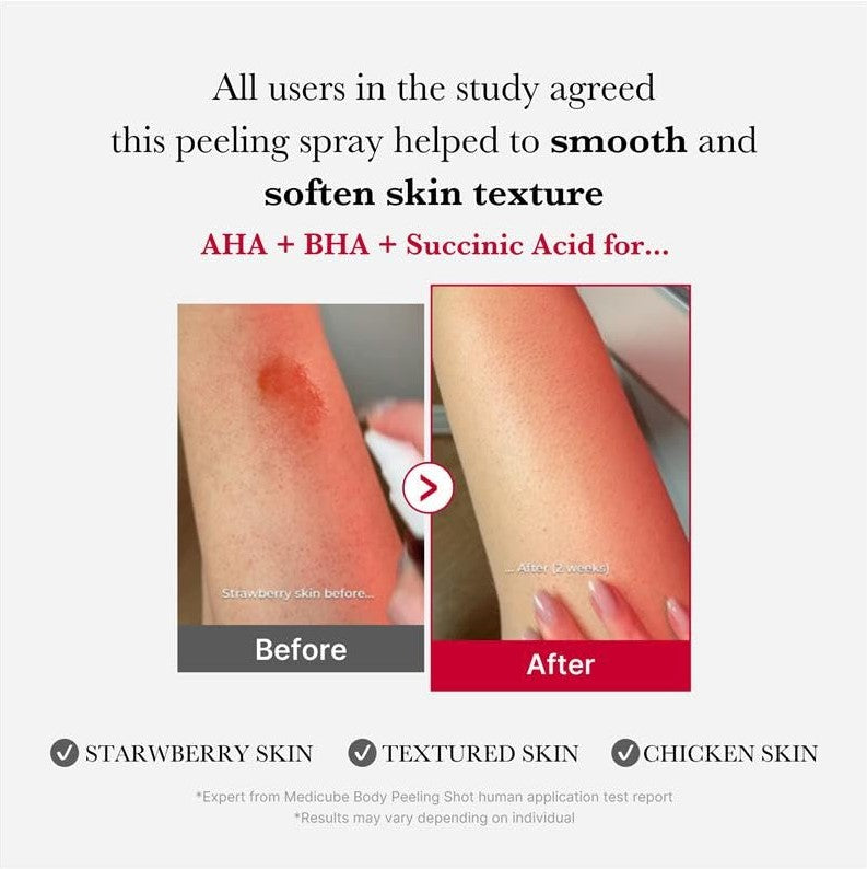 Red Body Peeling Shot Cleanser 110g / 3.88 oz.