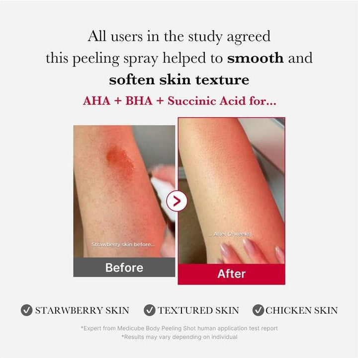 Red Body Peeling Shot Cleanser 110g / 3.88 oz.