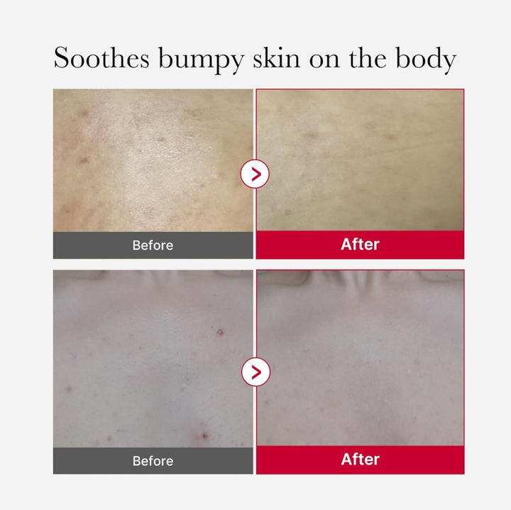 Red Body Peeling Shot Cleanser 110g / 3.88 oz.