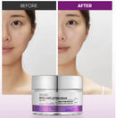 Reedle Shot Lifting Cream 50ml / 1.69 fl. oz.