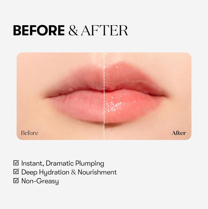 Reedle Shot Lip Plumper 0.15 oz 4.3g Beginner