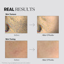 TX Toning Essence 1000 Shot 1.01 fl. oz. / 30ml