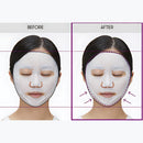 Reedle Shot Lifting Mask 1ea