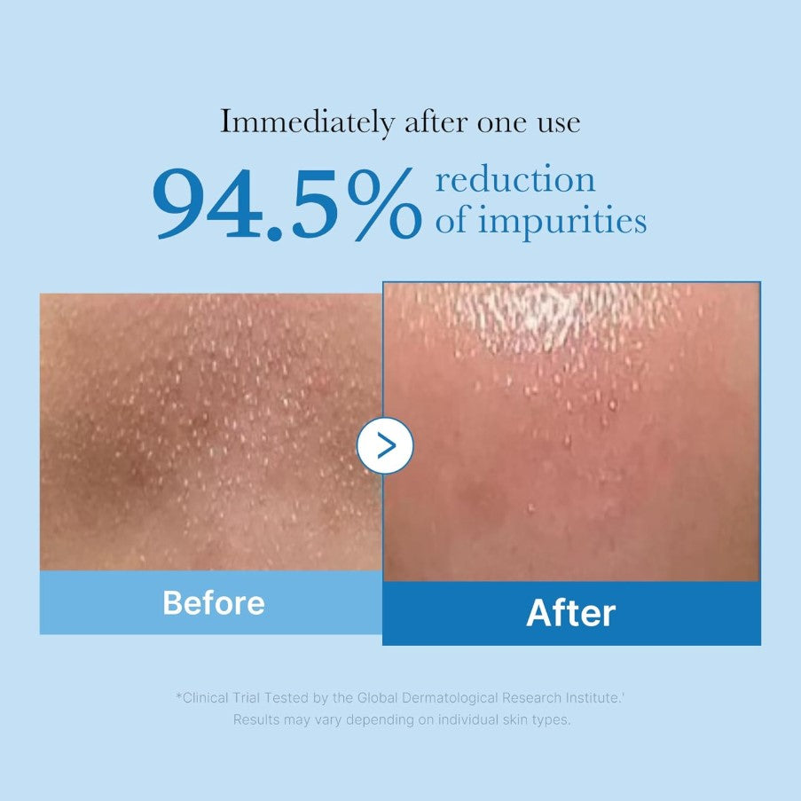 Zero Pore Blackhead Deep Cleansing Oil 205ml / 6.93 fl. oz.