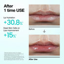 PDRN Hyaluron Lip Serum 10ml