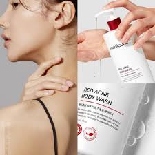 Medicube Red Acne Body Wash 400g