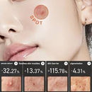Heartleaf + Centella Red Spot Cream 30g