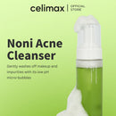 Noni Acne Bubble Cleanser 155ml