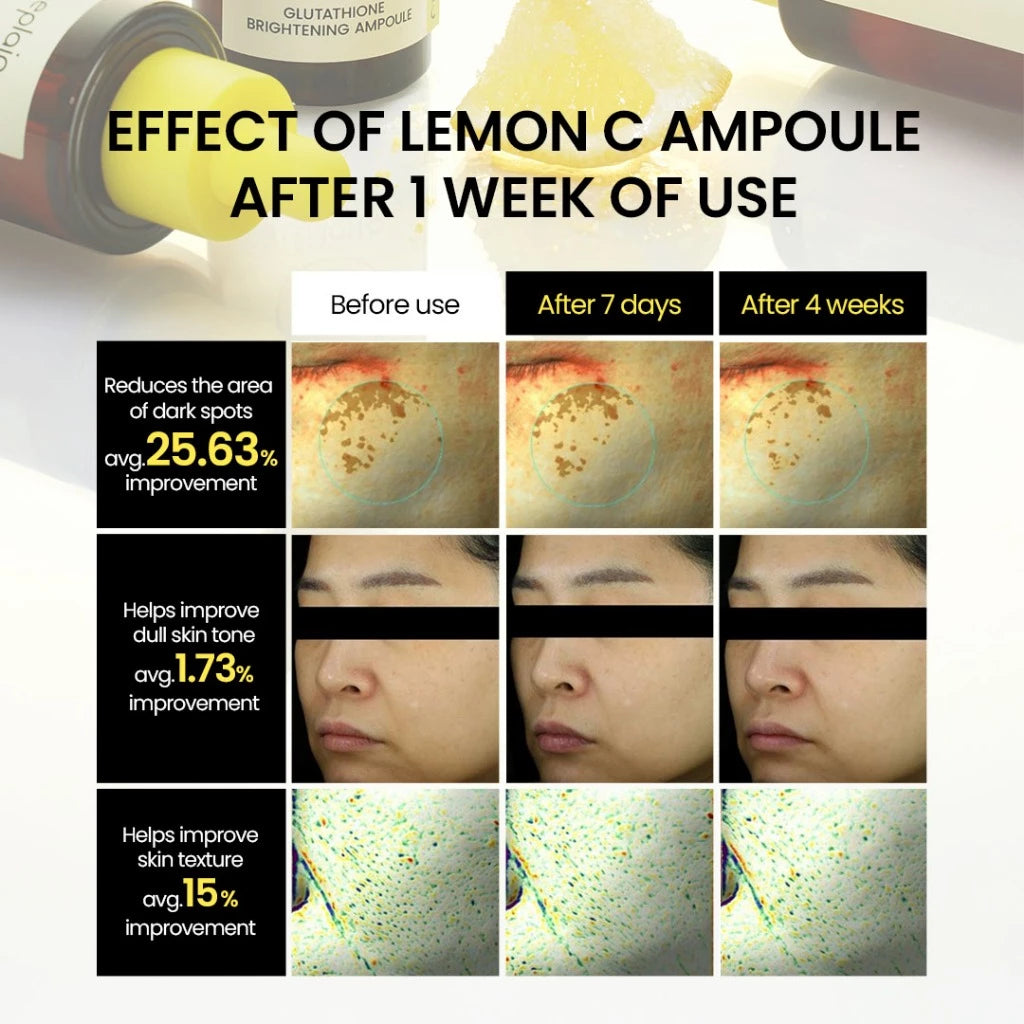 Lemon C Glutathione Brightening Ampoule 30ml