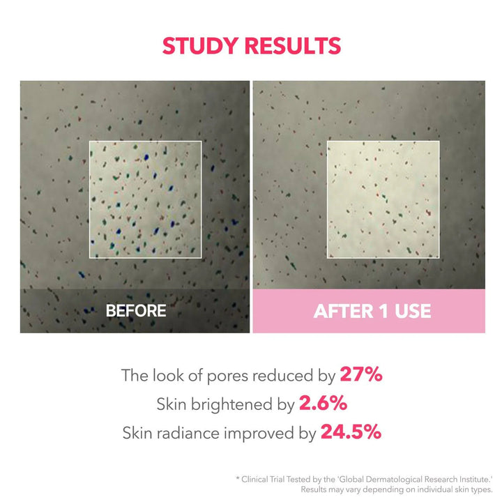 Aprilskin TXA Niacinamide 99 Night Wrapping Mask 80ml