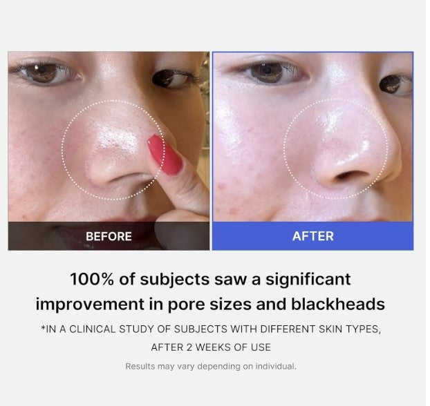 Zero Pore Pads 2.0 70 Pads /  155ml / 5.46 oz